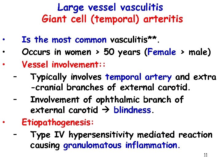 Large vessel vasculitis Giant cell (temporal) arteritis • • • Is the most common