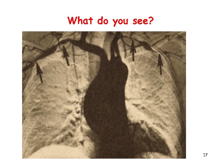 What do you see? 17 