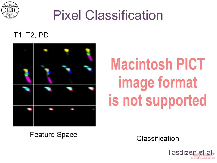 Pixel Classification T 1, T 2, PD Feature Space Classification Tasdizen et al. 
