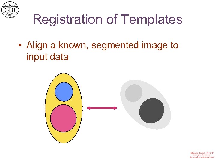 Registration of Templates • Align a known, segmented image to input data 