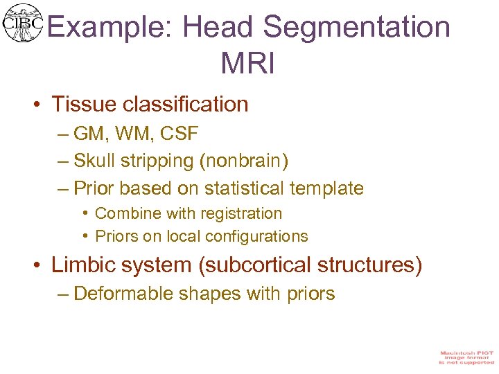 Example: Head Segmentation MRI • Tissue classification – GM, WM, CSF – Skull stripping