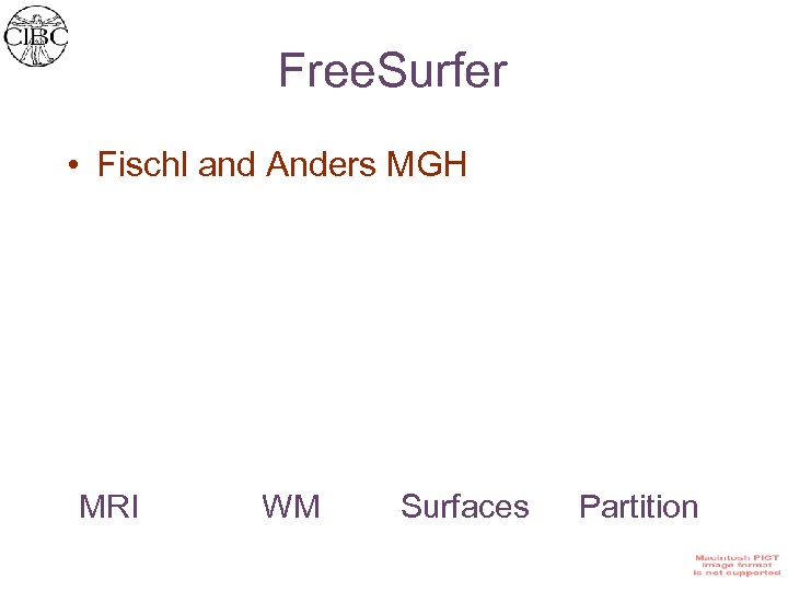 Free. Surfer • Fischl and Anders MGH MRI WM Surfaces Partition 