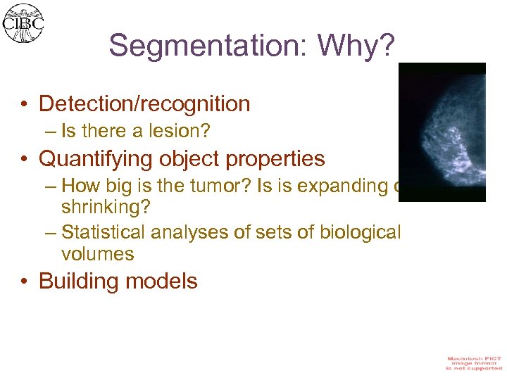 Segmentation: Why? • Detection/recognition – Is there a lesion? • Quantifying object properties –