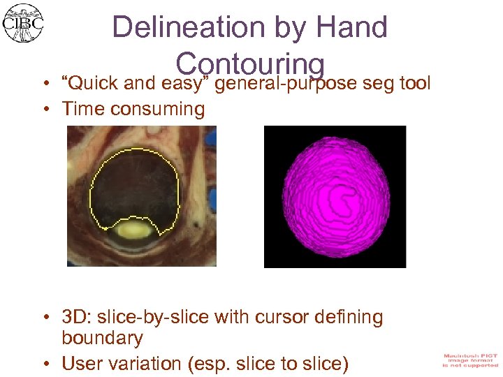 Delineation by Hand Contouring seg tool “Quick and easy” general-purpose • • Time consuming