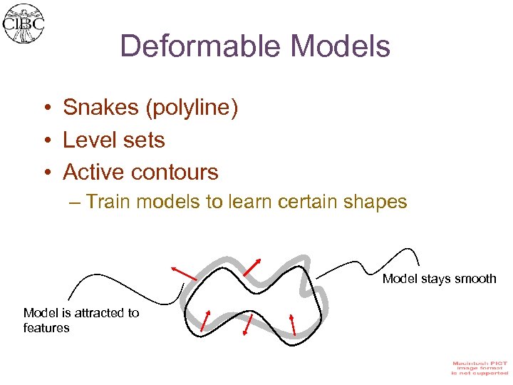 Deformable Models • Snakes (polyline) • Level sets • Active contours – Train models