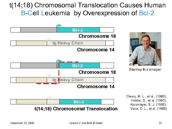 t(14; 18) Chromosomal Translocation Causes Human B-Cell Leukemia by Overexpression of Bcl-2 Chromosome 18