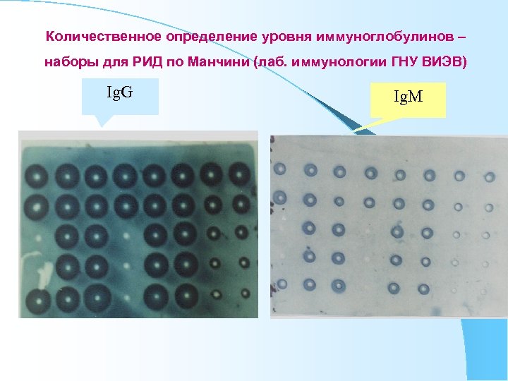 Количественное определение уровня иммуноглобулинов – наборы для РИД по Манчини (лаб. иммунологии ГНУ ВИЭВ)