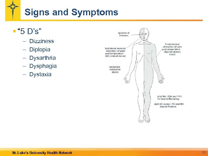 Signs and Symptoms § “ 5 D’s” – – – Dizziness Diplopia Dysarthria Dysphagia