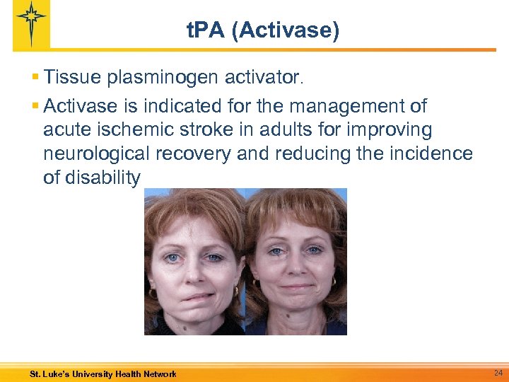 t. PA (Activase) § Tissue plasminogen activator. § Activase is indicated for the management