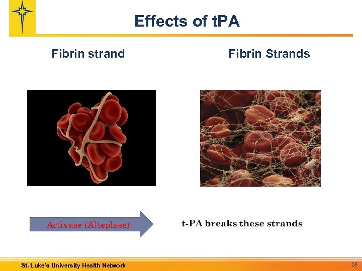 Effects of t. PA Fibrin strand Fibrin Strands Activase (Alteplase) St. Luke’s University Health