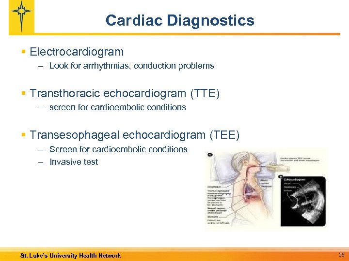 Cardiac Diagnostics § Electrocardiogram – Look for arrhythmias, conduction problems § Transthoracic echocardiogram (TTE)