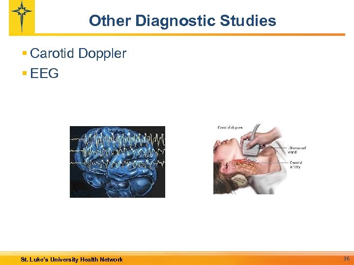 Other Diagnostic Studies § Carotid Doppler § EEG St. Luke’s University Health Network 36