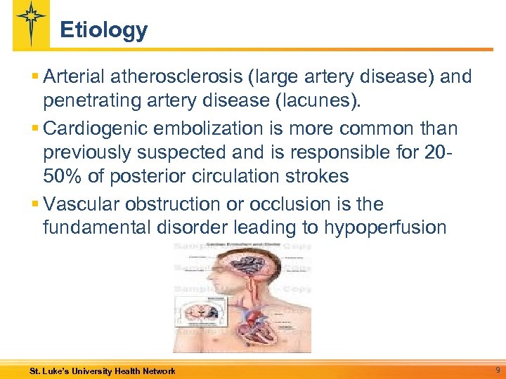 Etiology § Arterial atherosclerosis (large artery disease) and penetrating artery disease (lacunes). § Cardiogenic