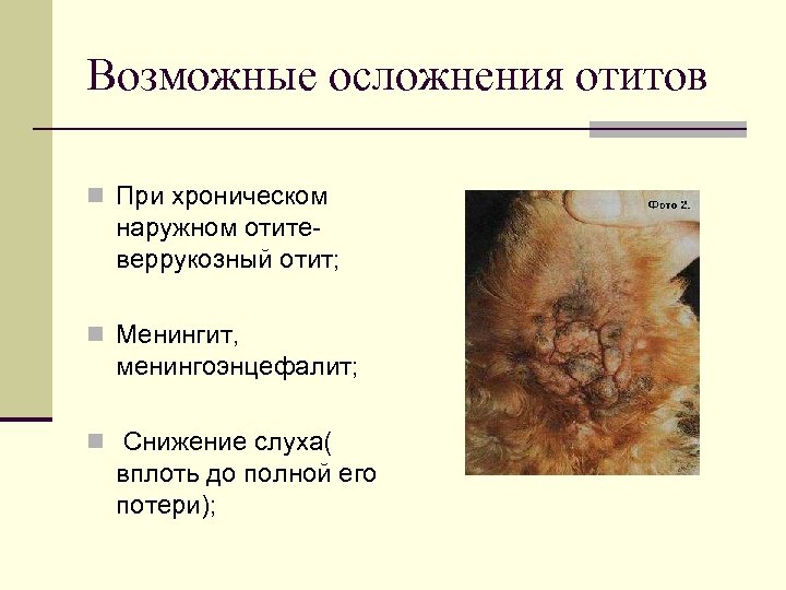 Возможные осложнения отитов n При хроническом наружном отитеверрукозный отит; n Менингит, менингоэнцефалит; n Снижение