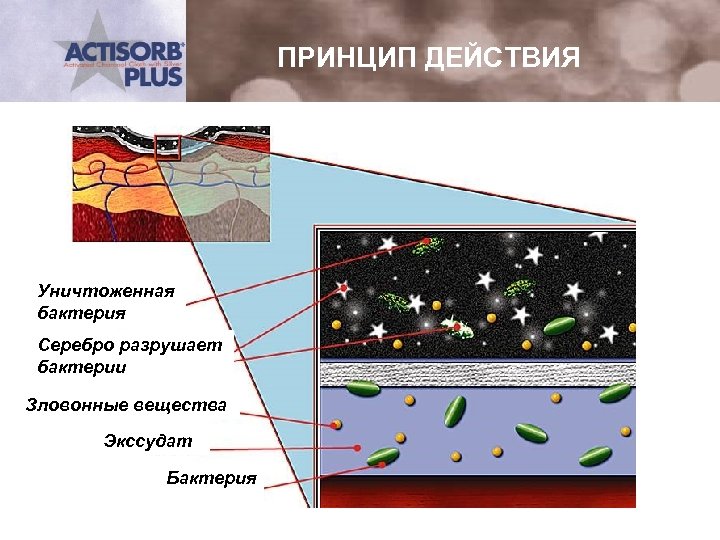 ПРИНЦИП ДЕЙСТВИЯ Уничтоженная бактерия Серебро разрушает бактерии Зловонные вещества Экссудат Бактерия 