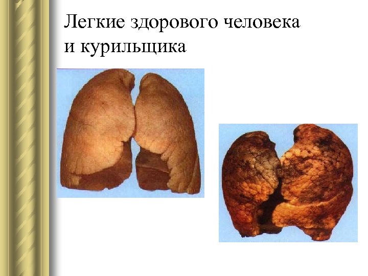 Легкие здорового человека и курильщика 
