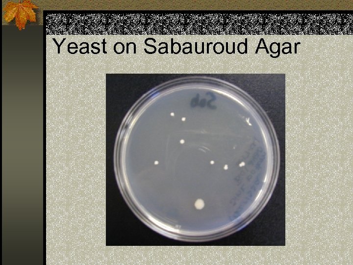 Yeast on Sabauroud Agar 