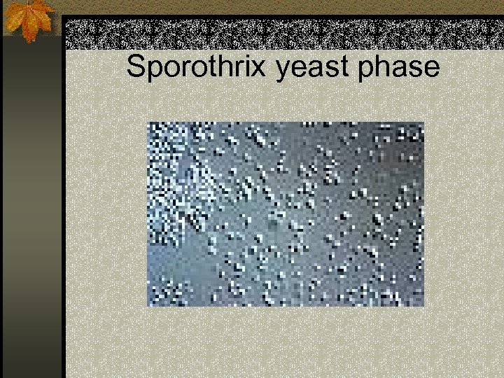 Sporothrix yeast phase 