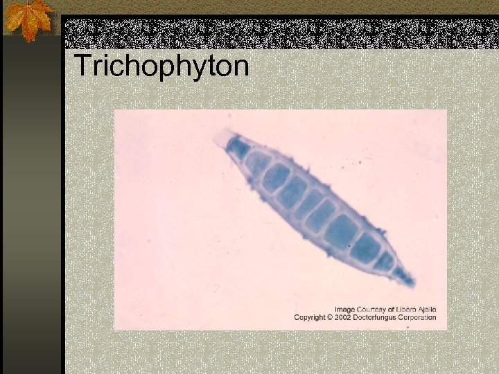 Trichophyton 