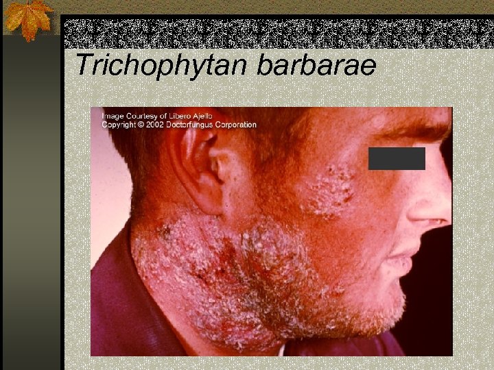 Trichophytan barbarae 