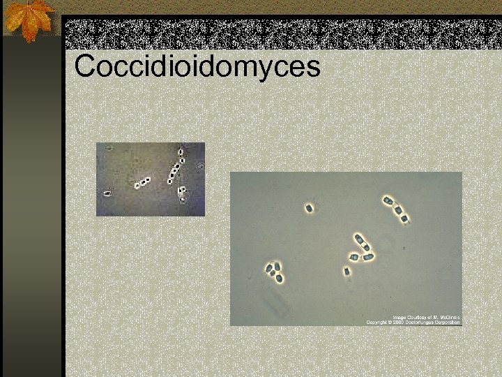 Coccidioidomyces 
