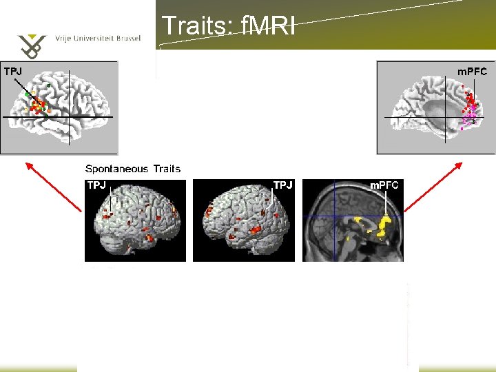 Traits: f. MRI 