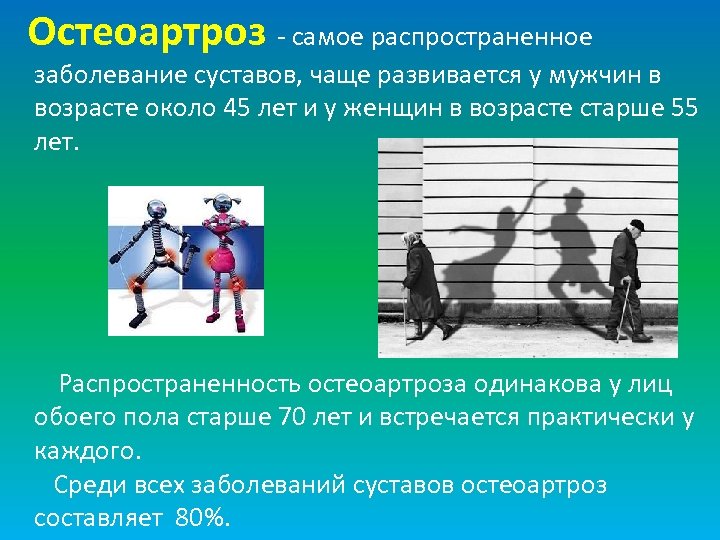 Остеоартроз - самое распространенное заболевание суставов, чаще развивается у мужчин в возрасте около 45
