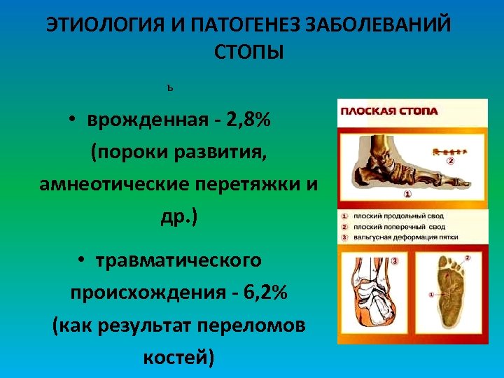 ЭТИОЛОГИЯ И ПАТОГЕНЕЗ ЗАБОЛЕВАНИЙ СТОПЫ Ъ • врожденная - 2, 8% (пороки развития, амнеотические