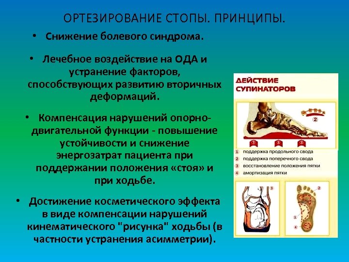 ОРТЕЗИРОВАНИЕ СТОПЫ. ПРИНЦИПЫ. • Снижение болевого синдрома. • Лечебное воздействие на ОДА и устранение