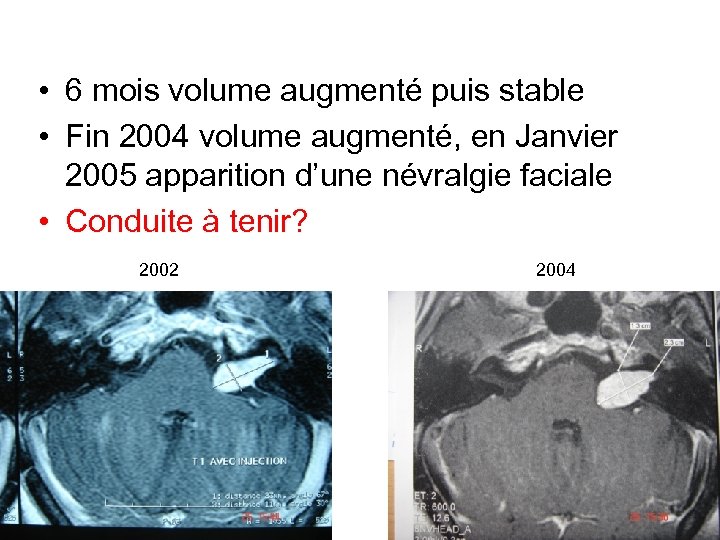  • 6 mois volume augmenté puis stable • Fin 2004 volume augmenté, en