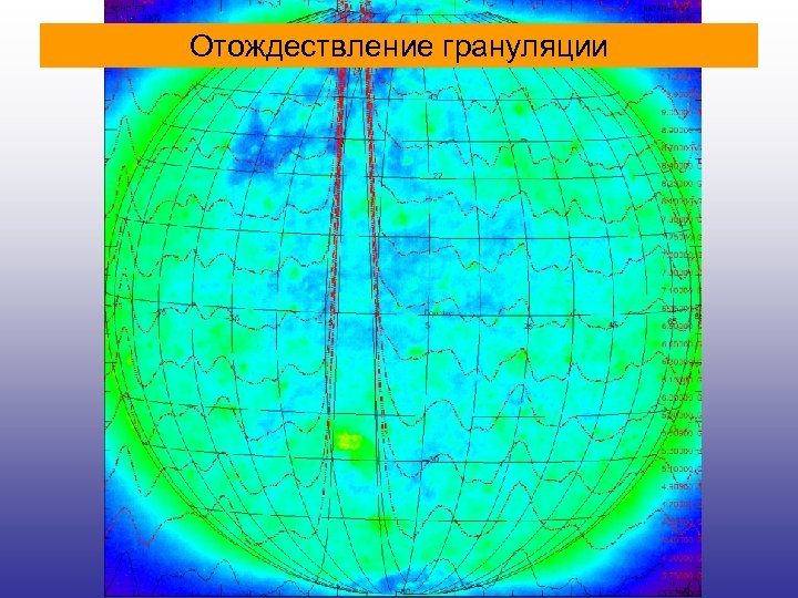 Отождествление грануляции 