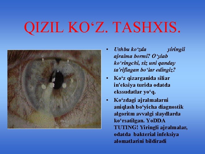 QIZIL KO‘Z. TASHXIS. • Ushbu ko‘zda yiringli ajralma bormi? O‘ylab ko‘ringchi, siz uni qanday