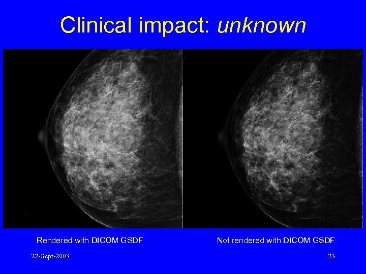 Clinical impact: unknown Rendered with DICOM GSDF 22 -Sept-2003 Not rendered with DICOM GSDF