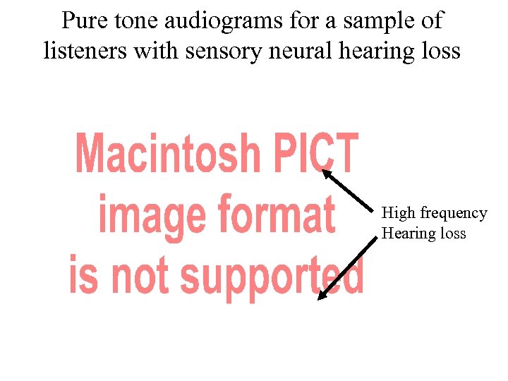 Pure tone audiograms for a sample of listeners with sensory neural hearing loss High