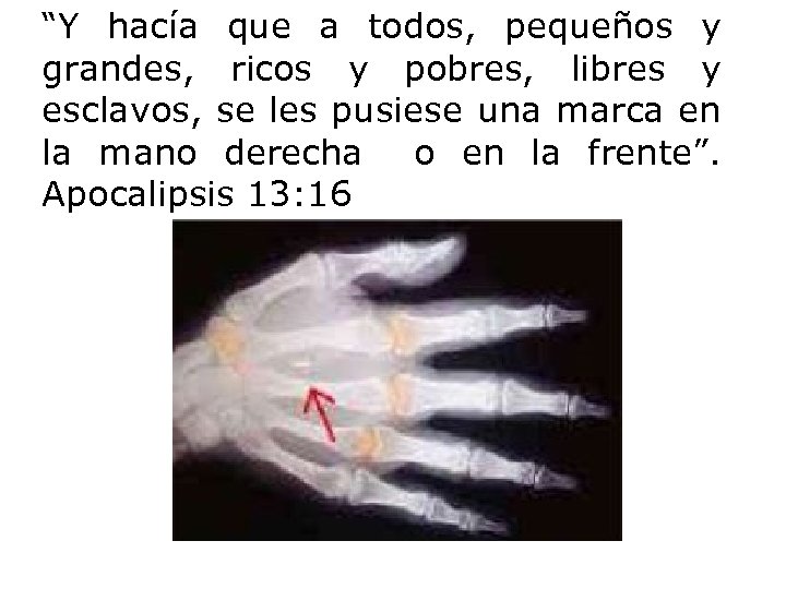 “Y hacía que a todos, pequeños y grandes, ricos y pobres, libres y esclavos,