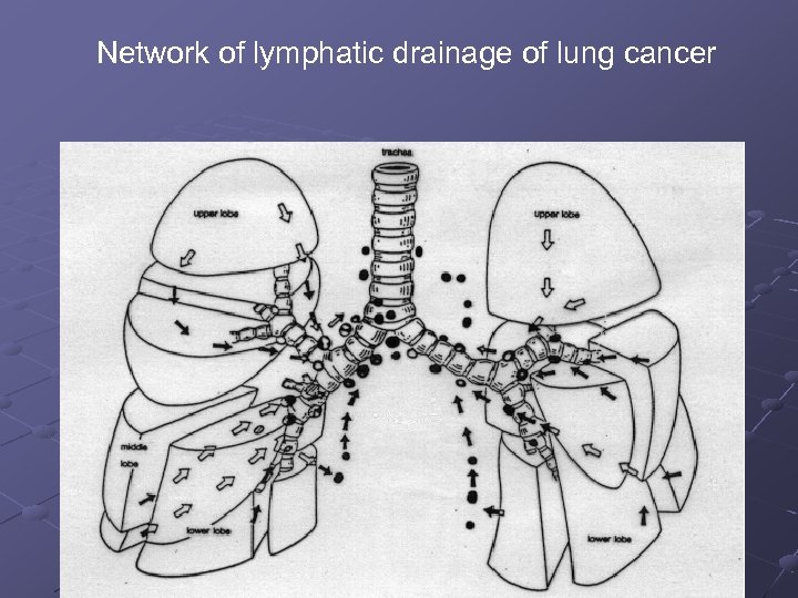 Network of lymphatic drainage of lung cancer 