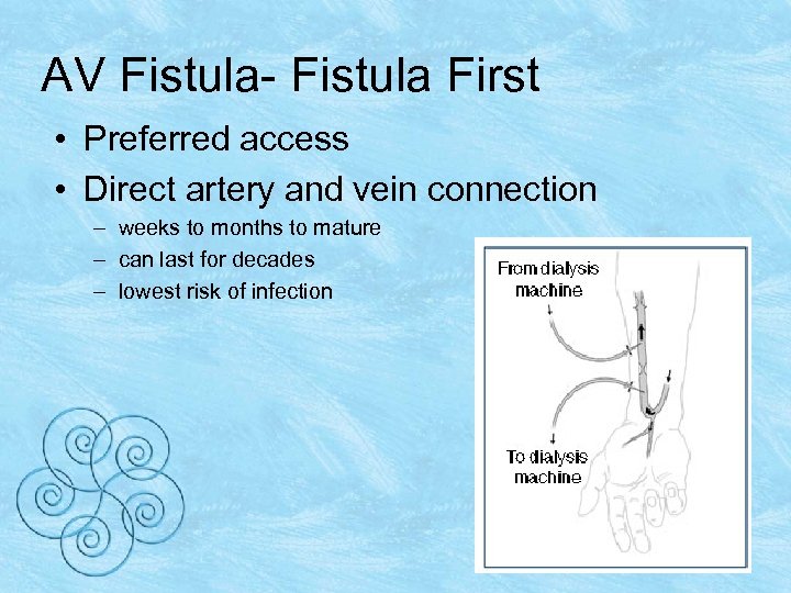 AV Fistula- Fistula First • Preferred access • Direct artery and vein connection –