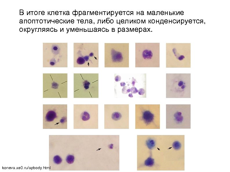 В итоге клетка фрагментируется на маленькие апоптотические тела, либо целиком конденсируется, округляясь и уменьшаясь