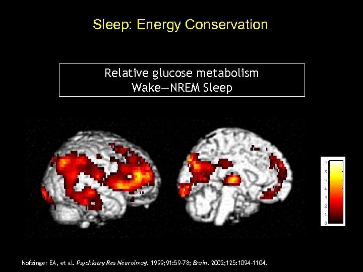 Sleep: Energy Conservation Relative glucose metabolism Wake—NREM Sleep T value Nofzinger EA, et al.