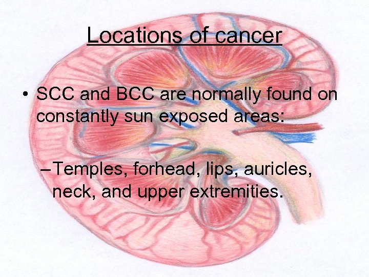 Locations of cancer • SCC and BCC are normally found on constantly sun exposed