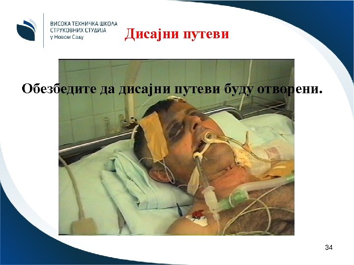 Дисајни путеви Обезбедите да дисајни путеви буду отворени. 34 