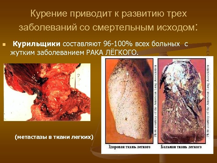 Курение приводит к развитию трех заболеваний со смертельным исходом: n Курильщики составляют 96 -100%