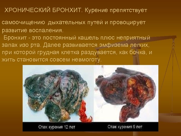  ХРОНИЧЕСКИЙ БРОНХИТ. Курение препятствует самоочищению дыхательных путей и провоцирует развитие воспаления. Бронхит -