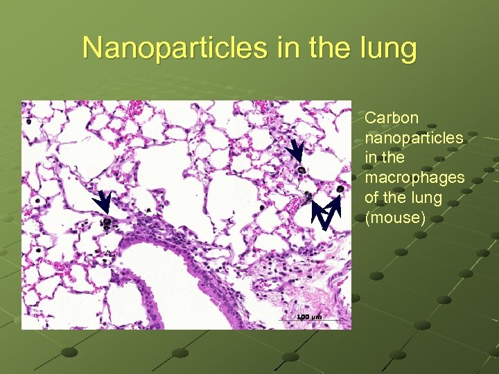 Nanoparticles in the lung Carbon nanoparticles in the macrophages of the lung (mouse) 