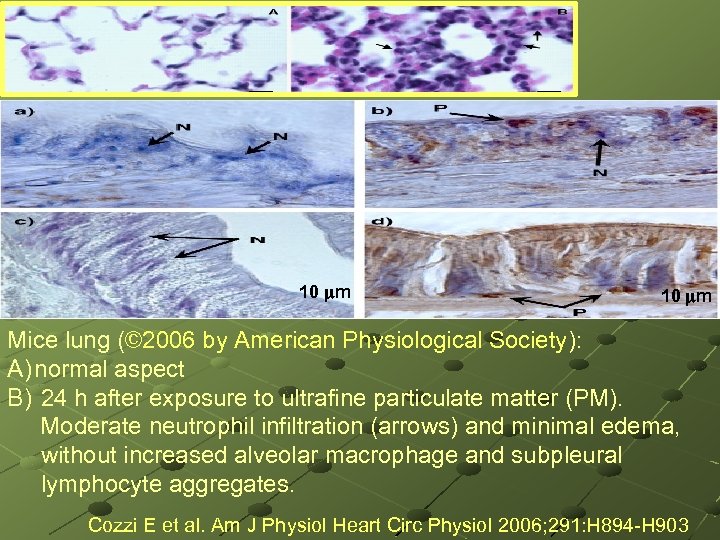 . 10 m Mice lung (© 2006 by American Physiological Society): A) normal aspect