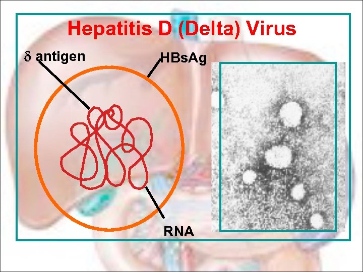 Hepatitis D (Delta) Virus d antigen HBs. Ag RNA 