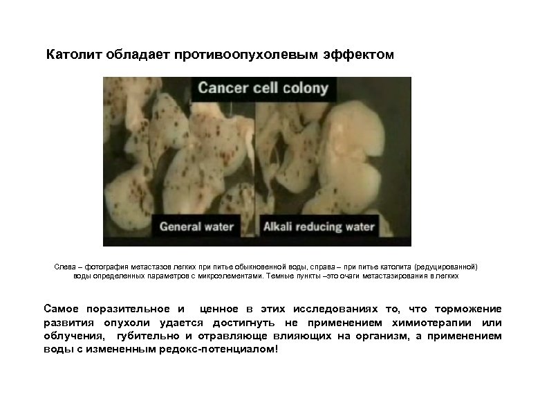 Католит обладает противоопухолевым эффектом Слева – фотография метастазов легких при питье обыкновенной воды, справа