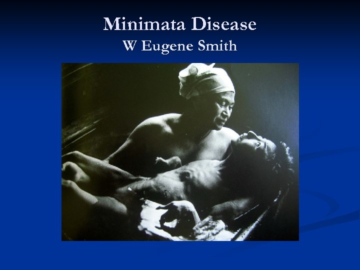 Minimata Disease W Eugene Smith 