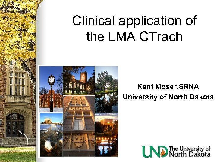 Clinical application of the LMA CTrach Kent Moser, SRNA University of North Dakota 