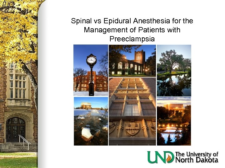 Spinal vs Epidural Anesthesia for the Management of Patients with Preeclampsia 